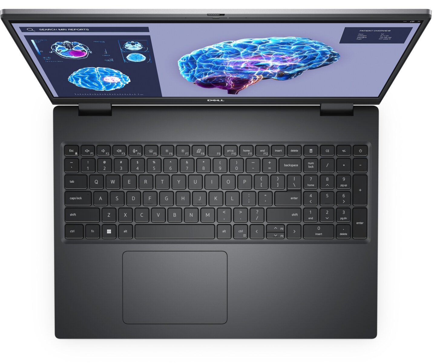 Dell Precision 7680 16" de segunda mano · vista 4 de 6